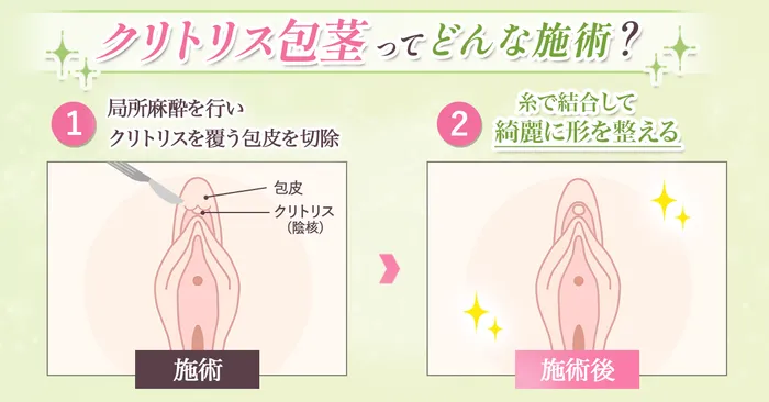 仕組み