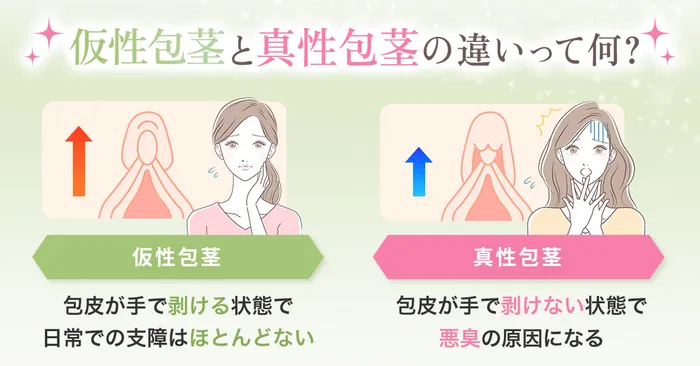仕組み