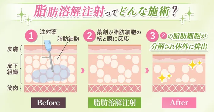仕組み化