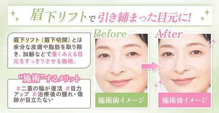 イメージの差