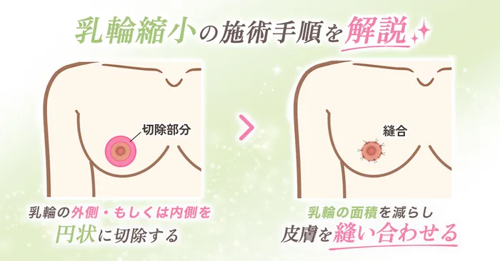 ロジック
