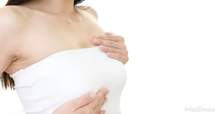 【目的別】乳輪縮小のおすすめクリニックを厳選!バランスのとれた美しいバストへ