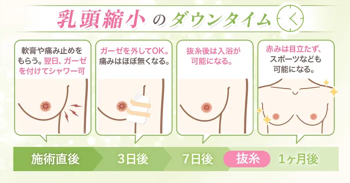 ダウンタイム