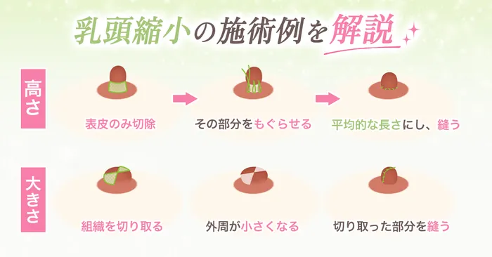 ロジック