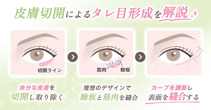 ロジック