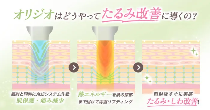 効果のロジック
