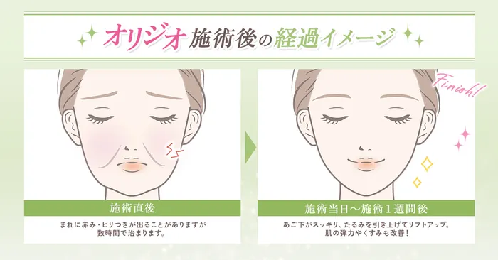 ダウンタイム