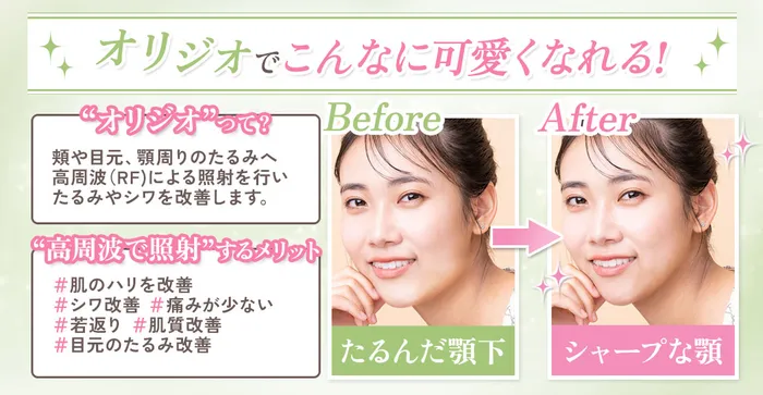 イメージの差