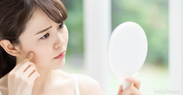 小鼻縮小の傷跡が目立つときは別の施術に頼ってみるのもあり!おすすめの施術3選