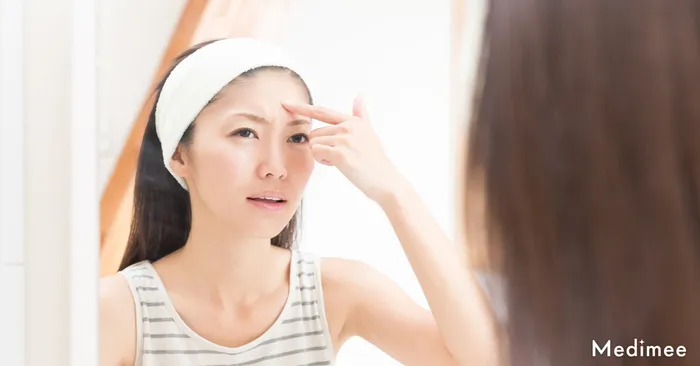 眉間ボトックスでシワ改善に効果が出る人と出ない人のシワタイプ違い!
