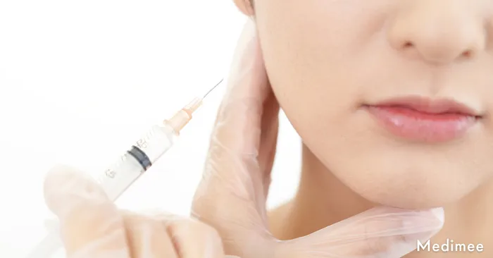 スキンボトックスの効果はいつからいつまで続くの?効果の持続期間について詳しく解説します