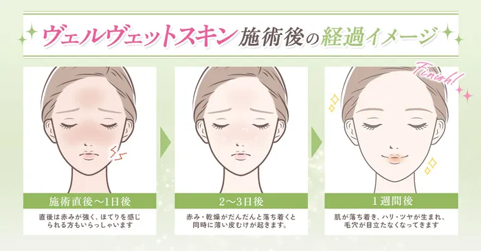ダウンタイム