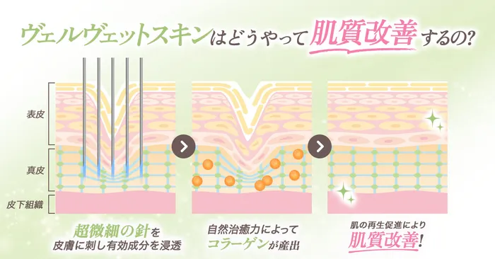 効果のロジック