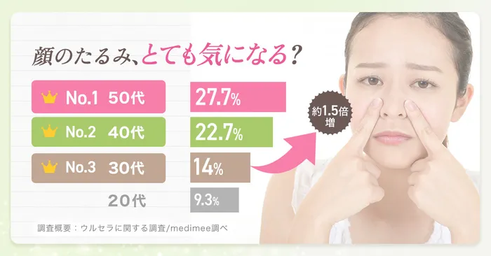アンケート