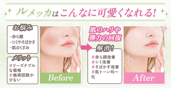 イメージの差