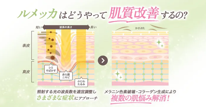 効果のロジック