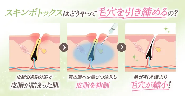 効果のロジック