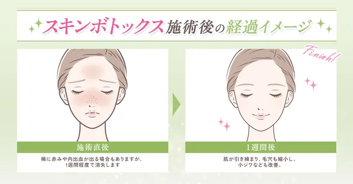 ダウンタイム