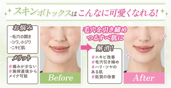 イメージの差
