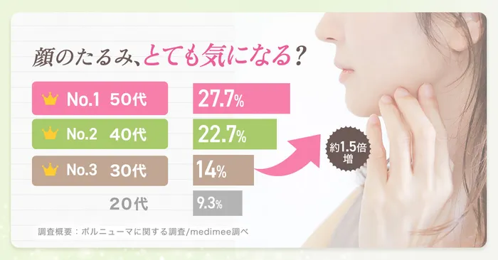 アンケート