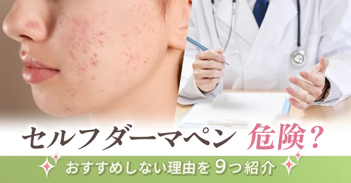 ダーマペンはセルフでやると危険?おすすめしない理由とは
