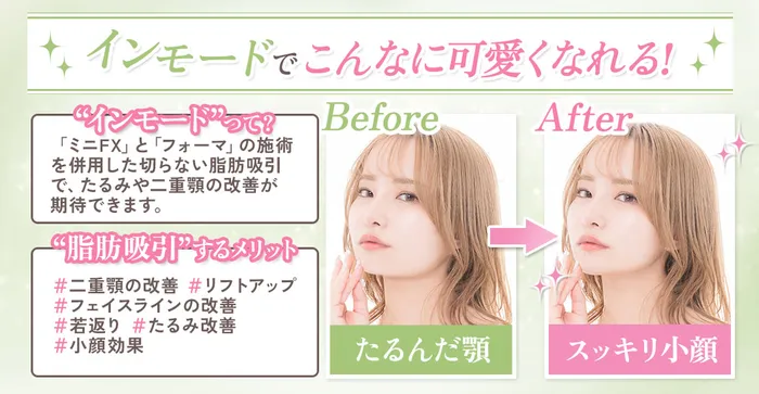 イメージの差