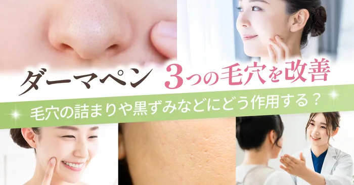 ダーマペンで改善が期待できる毛穴トラブルの種類は3つ!当てはまる人にはおすすめ