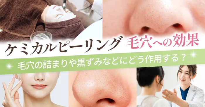 ケミカルピーリングは毛穴にどう作用する?期待できる主な効果とは