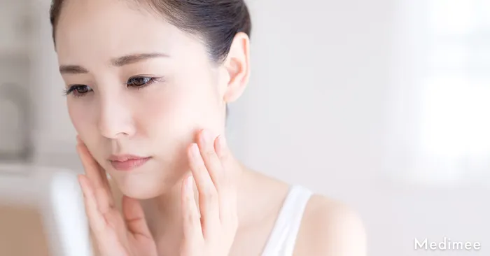 ポテンツァでニキビ跡治療を行うと色素沈着が起きるって本当?元に戻る可能性もある?