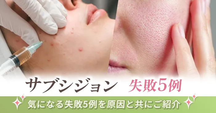 サブシジョンの失敗例とは?気になる失敗5例を原因と共にご紹介