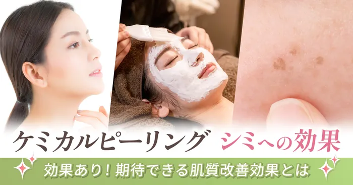 ケミカルピーリングはシミ改善効果がある!ケミカルピーリングで期待できる肌質改善効果をご紹介