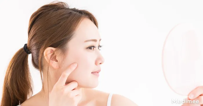 ポテンツァのクレーター改善効果をしっかり感じるにはどうすればいいの?施術後に意識したいポイントをご紹介