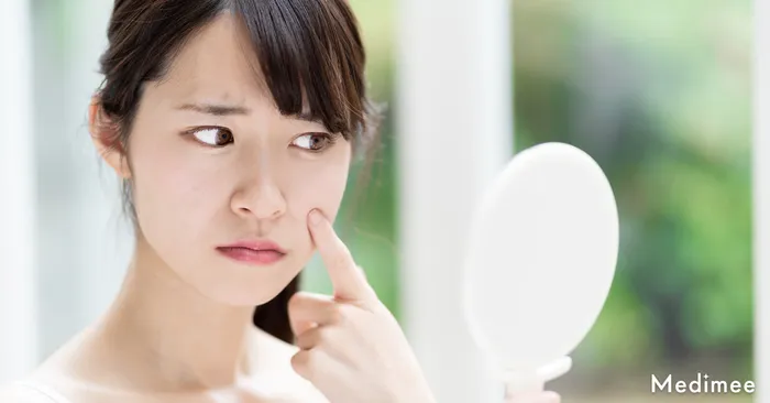 サブシジョンで得られる効果5つとは?どんなニキビ跡に向いている?
