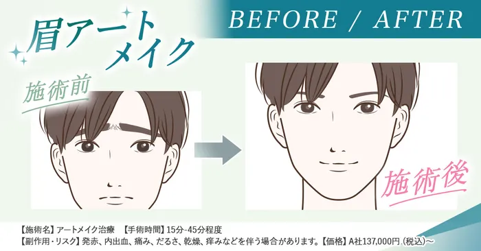 【徹底比較】1番安くアートメイクを受けられるおすすめのクリニックはどこ？痛みやダウンタイムの経過と合わせて徹底調査