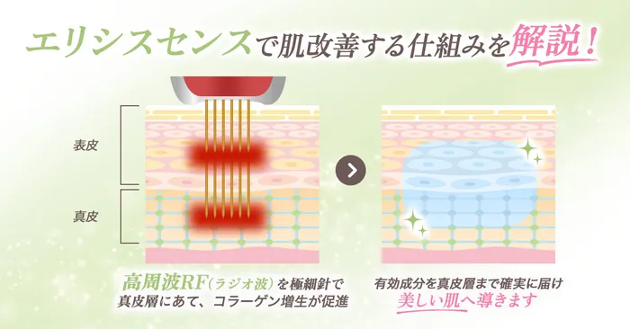 ロジック