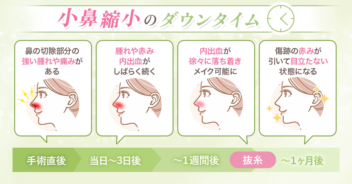 ダウンタイム画像