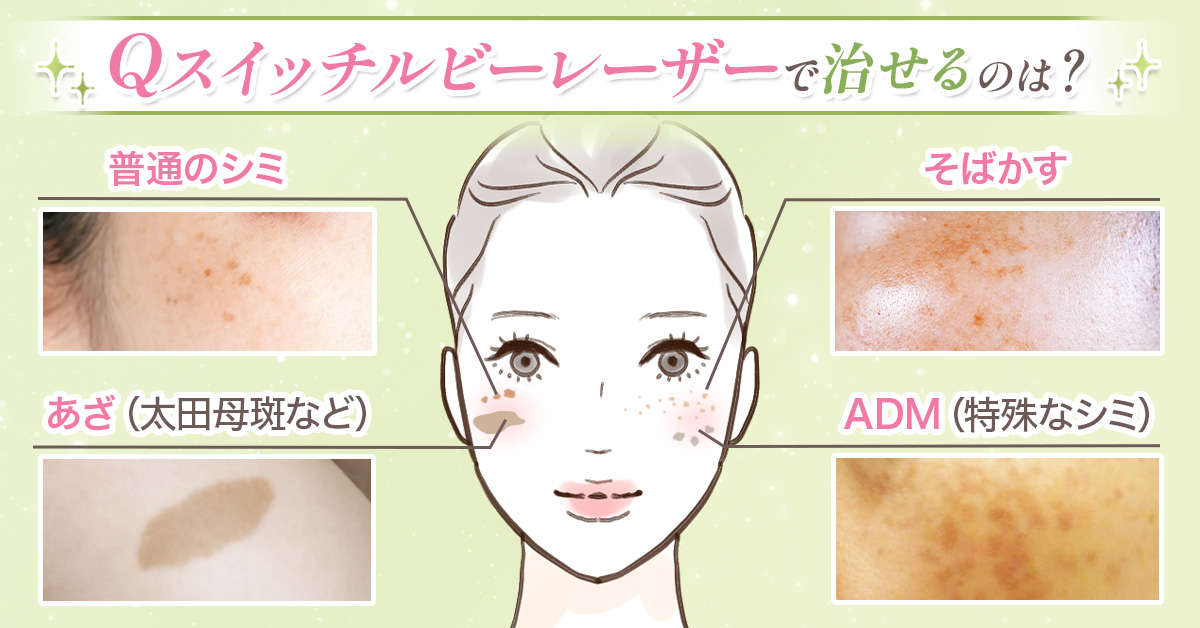 自分ごと