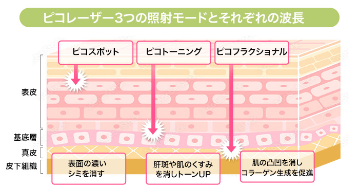 ピコレーザー3つの照射モード