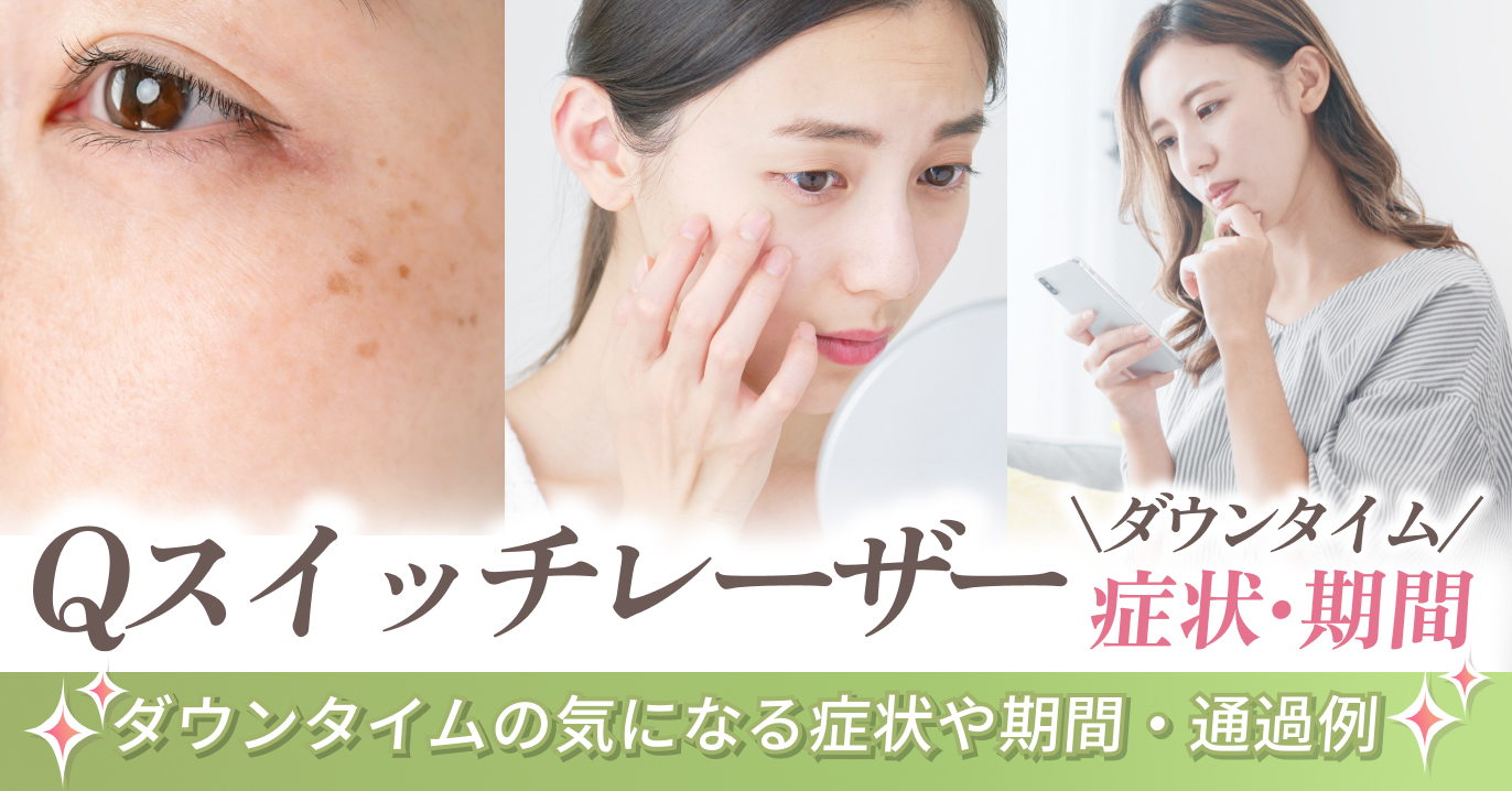 Qスイッチレーザーのダウンタイムの気になる症状や期間は?実際の経過例もご紹介