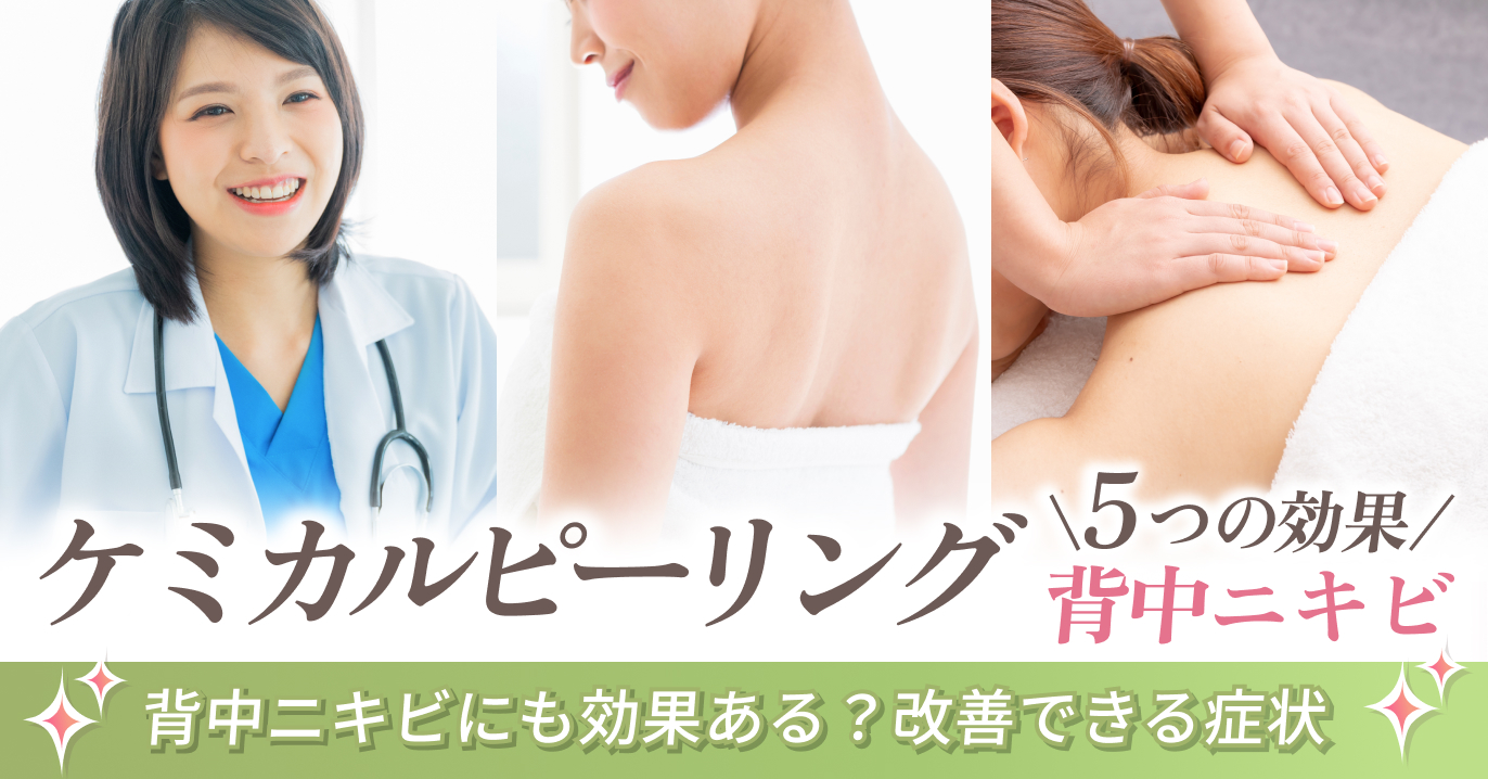 ケミカルピーリングは背中ニキビにも効果ある?期待できる5つの効果とは